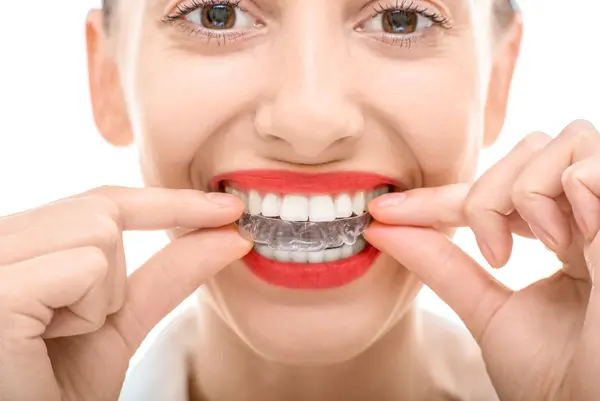 Woman putting into top aligners